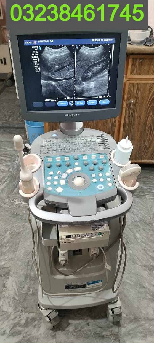 siemions sonovista FX( LCD) japanese ultrasound machine 0