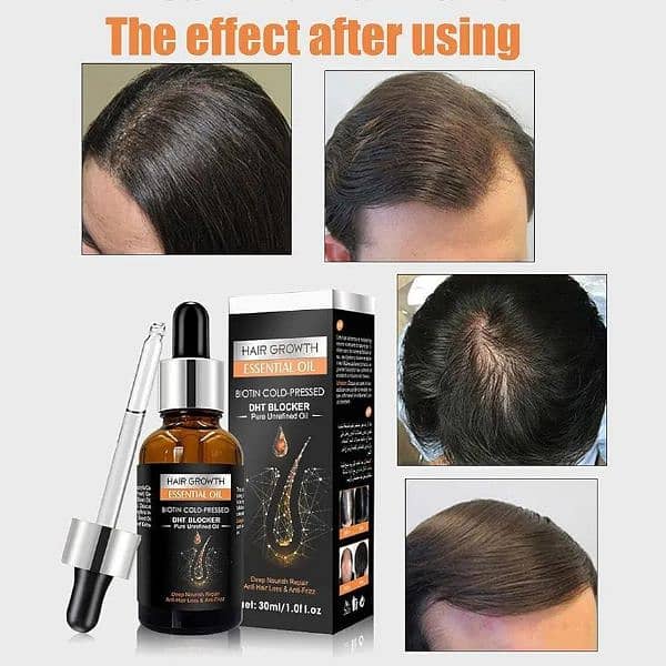 Hair growth shampoo + Essential oils for hair growth 3