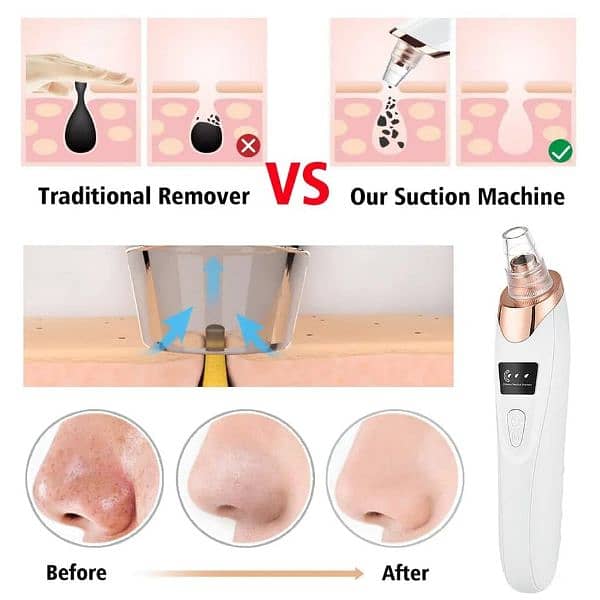 Multifunctional Instrument Blackhead Remover (Free Delivery) 1