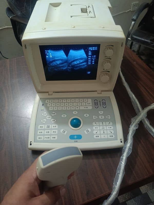 Ultrasound machine 17