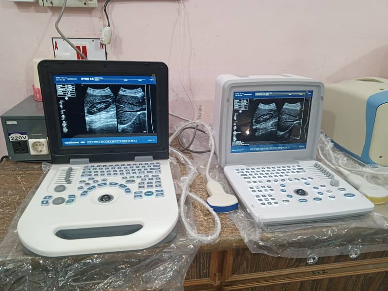 Brand new Ultrasound machine Chinese (with or without battery backup) 0