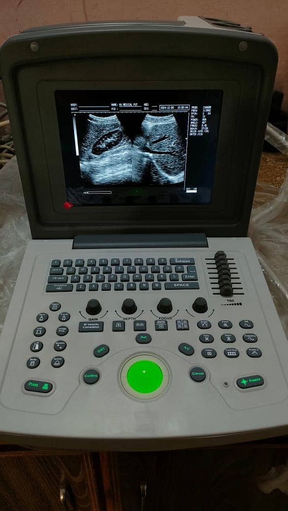 Brand new Ultrasound machine Chinese (with or without battery backup) 2