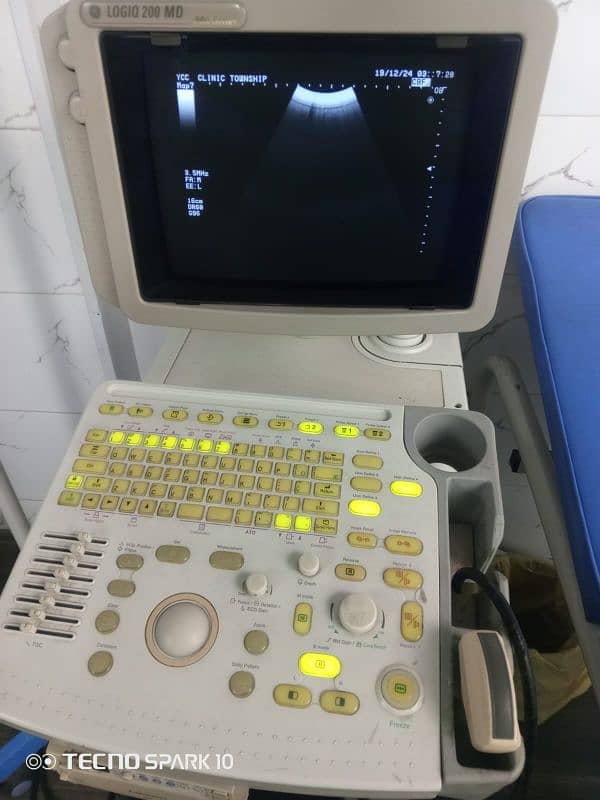 ultrasound Machine 2