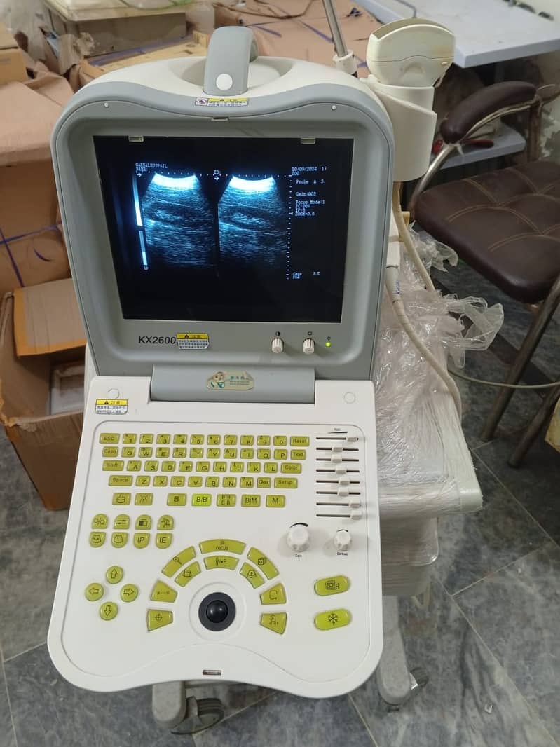 Forighn Use portable ultrasound machine available in stock with Convex 3