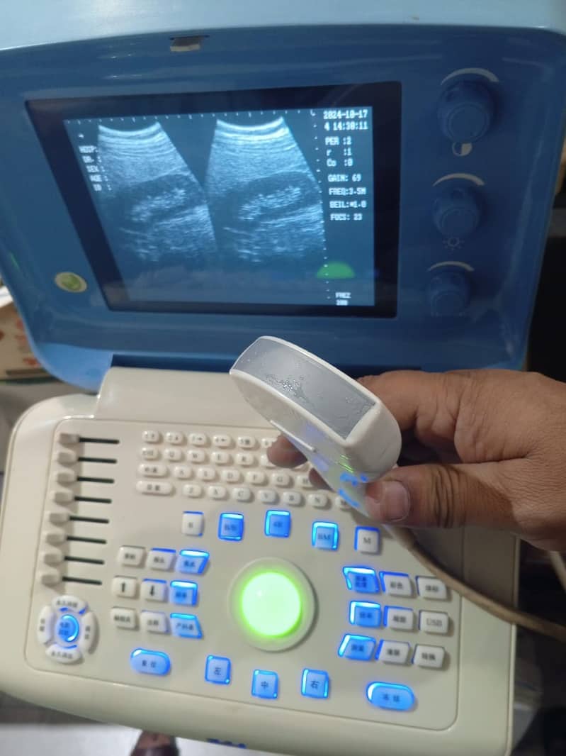 Forighn Use portable ultrasound machine available in stock with Convex 4