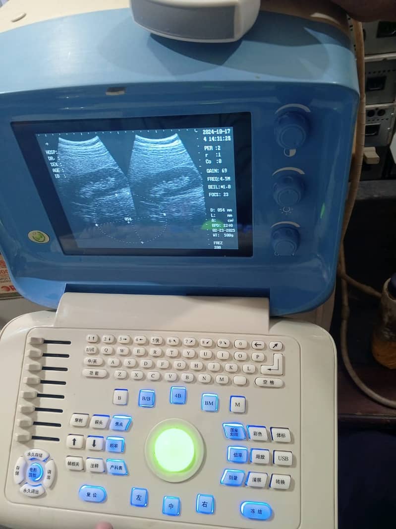 Forighn Use portable ultrasound machine available in stock with Convex 5