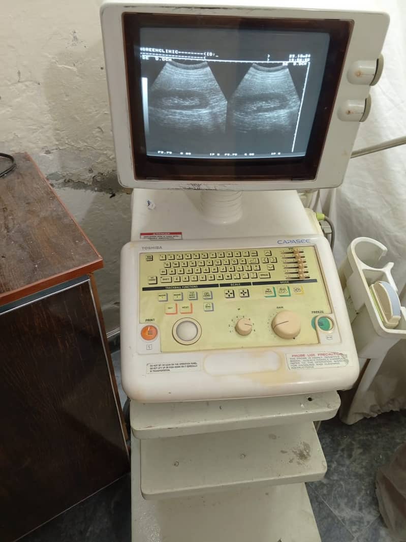 Forighn Use portable ultrasound machine available in stock with Convex 8