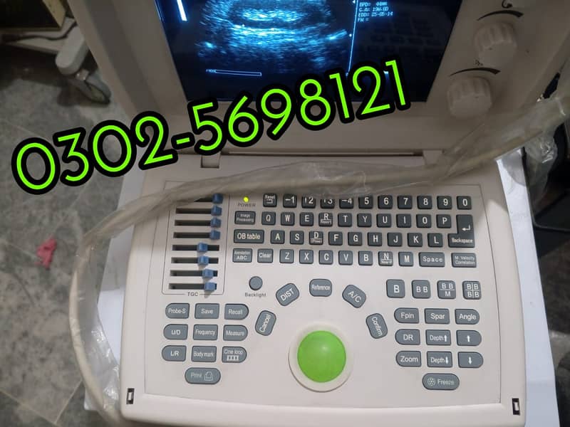 Forighn Use portable ultrasound machine available in stock with Convex 3