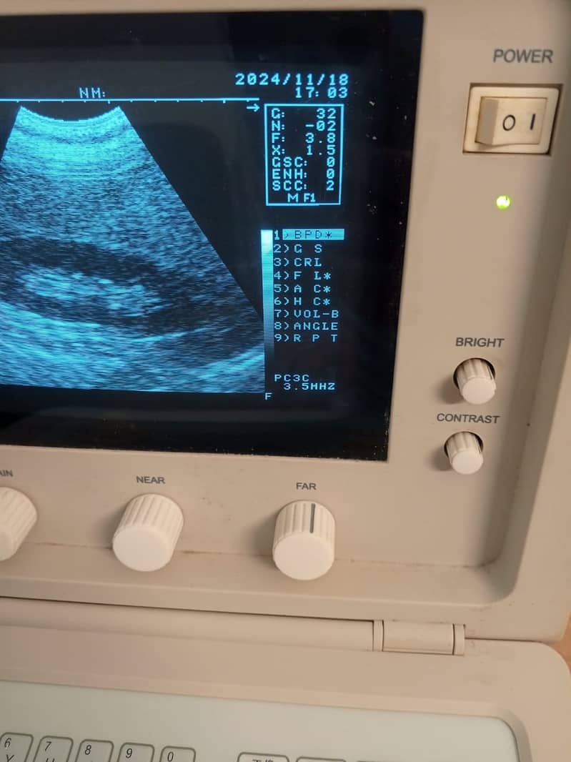 Brand New  ultrasound machine / portable ultrasound machine for sale 7