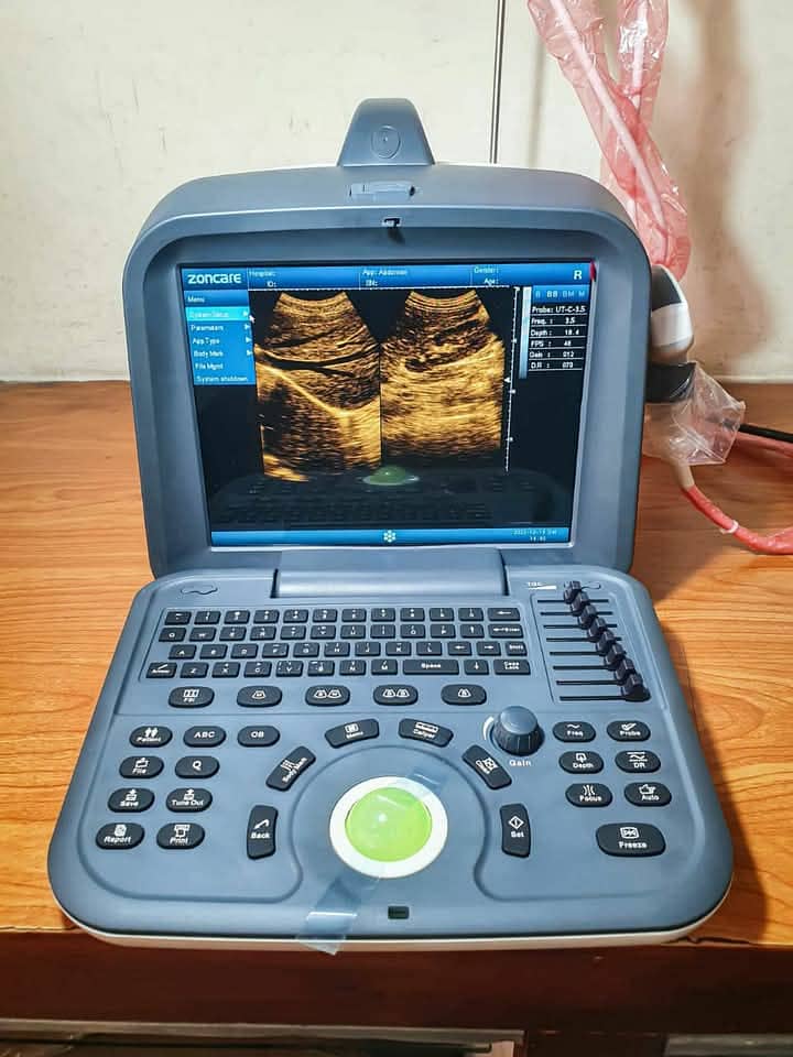 japanese Gray scale ultrasound machine,ultrasound machine, used, new 8