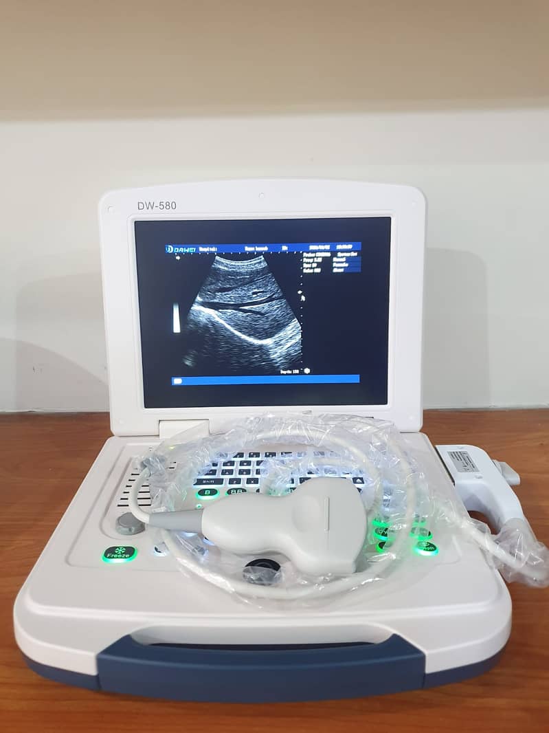 japanese Gray scale ultrasound machine,ultrasound machine, used, new 16