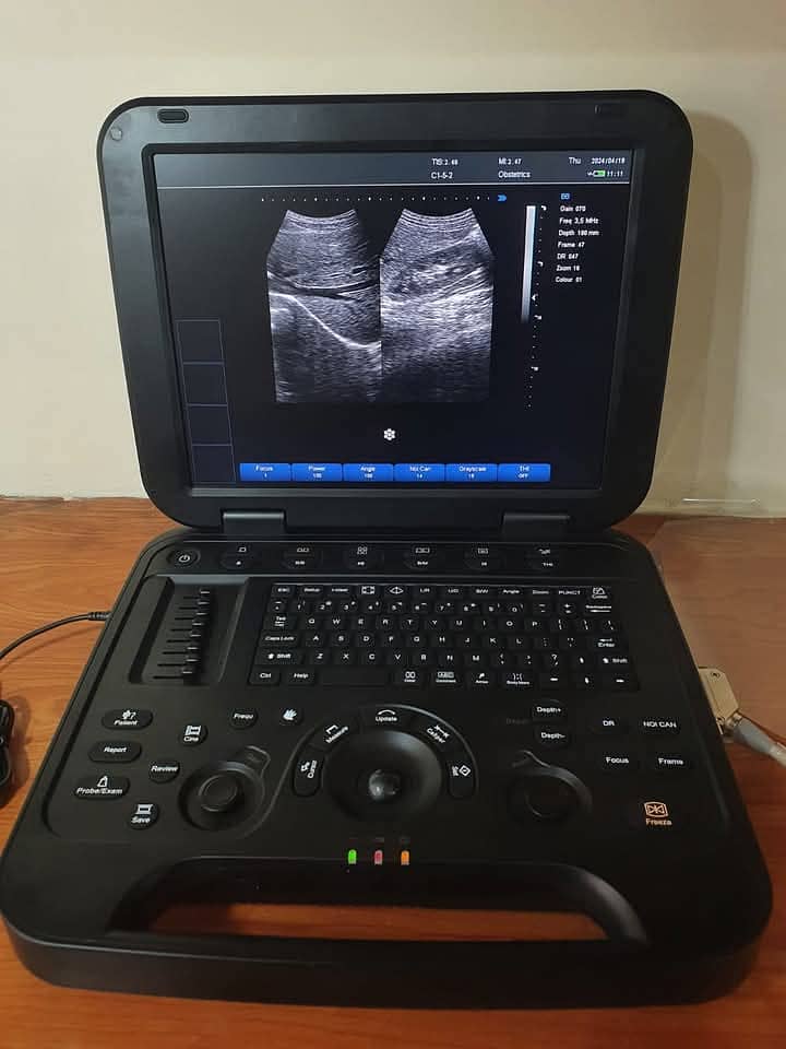 Brand New ultrasound machine , used ultrasound machines , lab repare 11