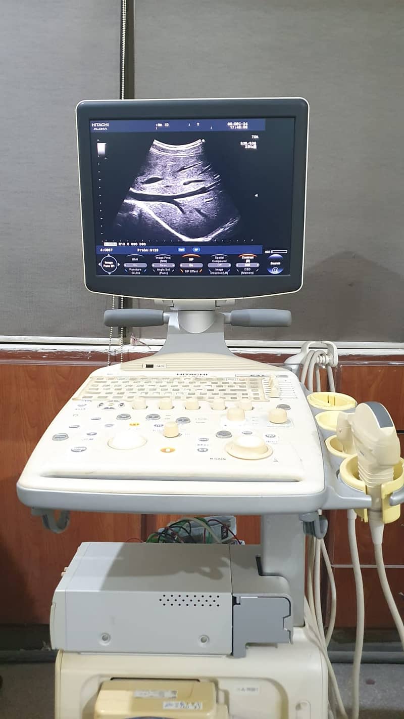 Brand New ultrasound machine , used ultrasound machines , lab repare 18