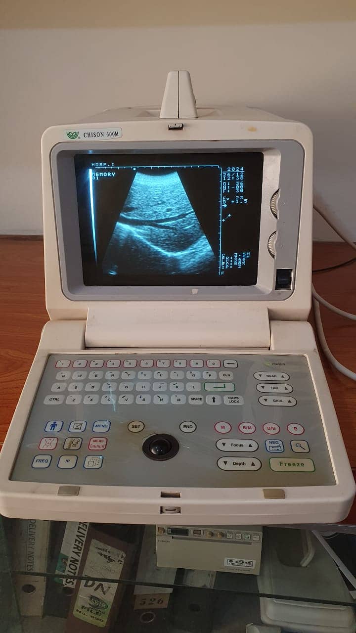 used portable ultrasound machine/ ultrasound machines 0