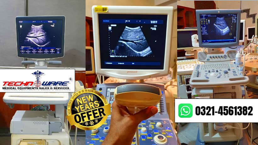 used portable ultrasound machine/ ultrasound machines 17