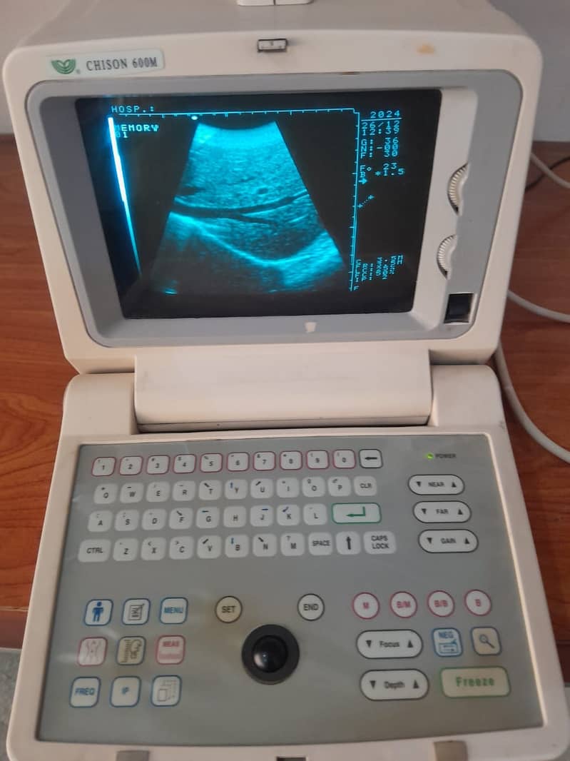 used portable ultrasound machine/ ultrasound machines 19