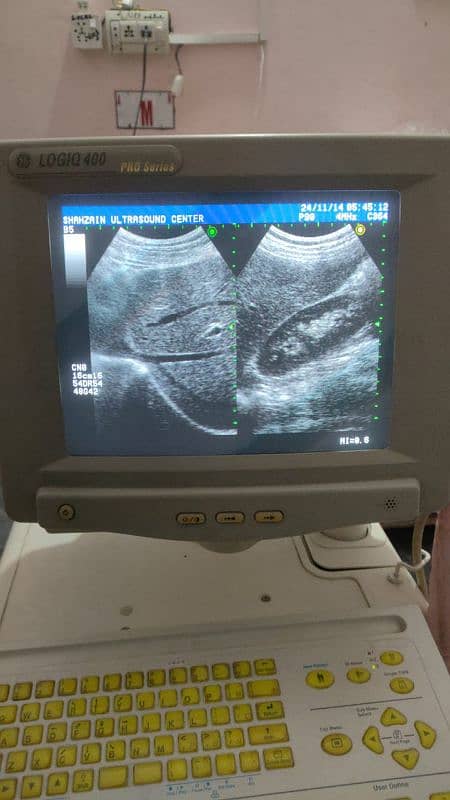 Color doppler Ultrasound machine Sale offer Whtsap-03126807471 1