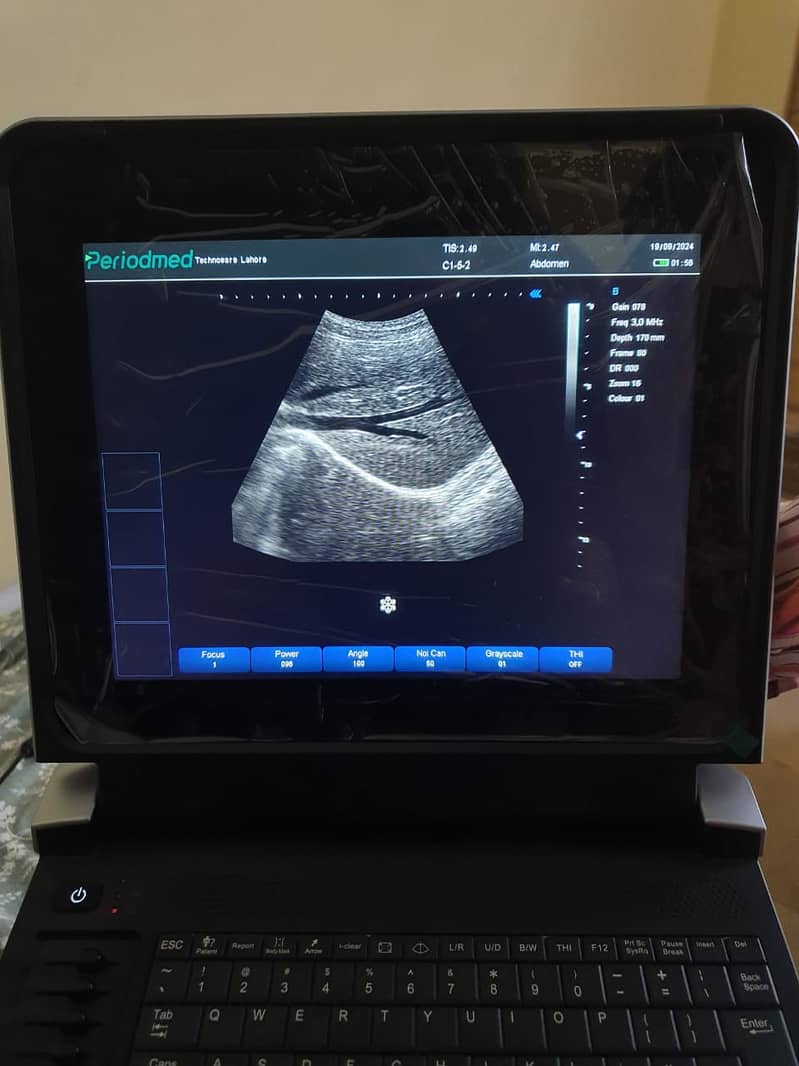 used portable ultrasound machine/ ultrasound machines 14