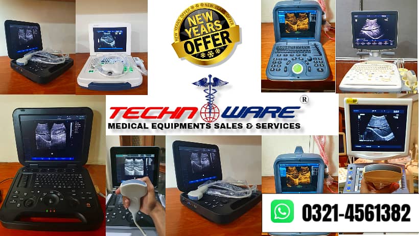 used portable ultrasound machine/ ultrasound machines 0