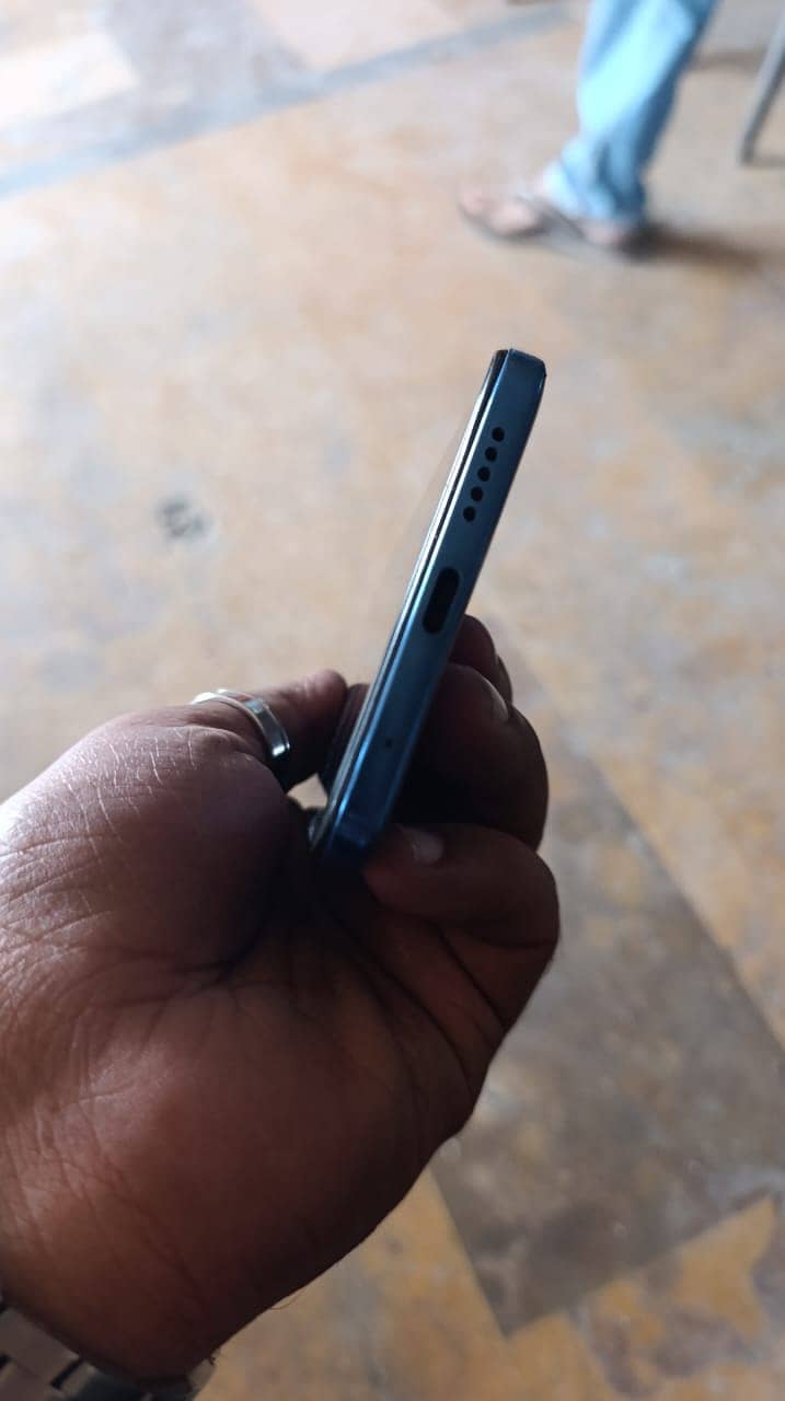 Xiaomi Redmi Note 11 Pro 3