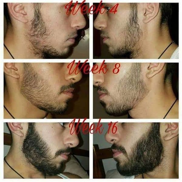 Patchy Beard & Pachy Hair Complete 100% Solution 0