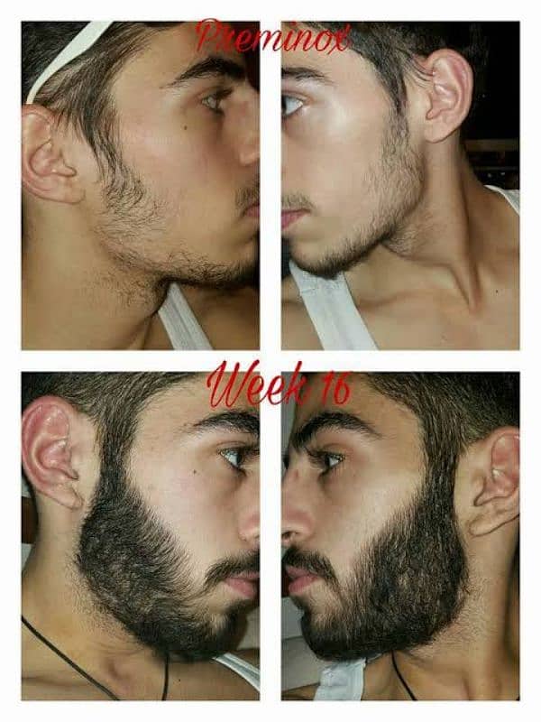 Patchy Beard & Pachy Hair Complete 100% Solution 7