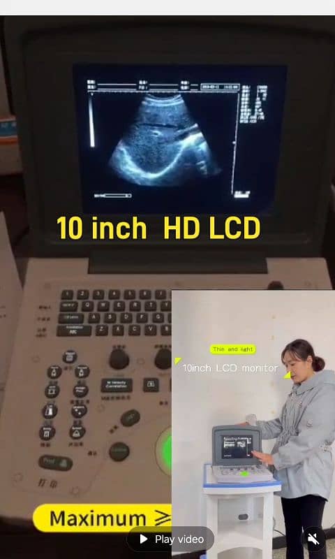 VOLTA 100 FULL DIGITAL BATTERY OPRATED ULTRASOUND MACHINE 2