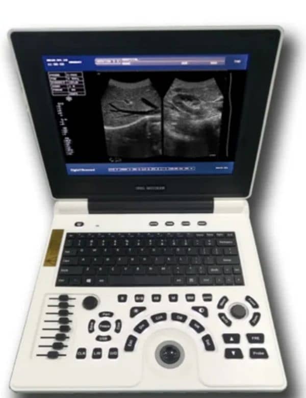 VOLTA 100 FULL DIGITAL BATTERY OPRATED ULTRASOUND MACHINE 17