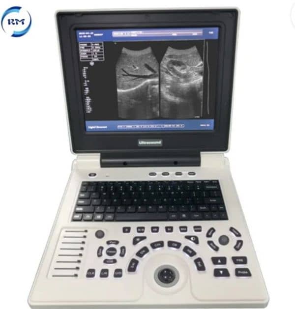 VOLTA 100 FULL DIGITAL BATTERY OPRATED ULTRASOUND MACHINE 18