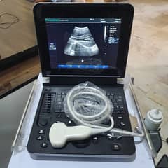 japanese Gray scale ultrasound machine/ ultrasound machine/ used/ new