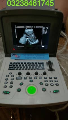 brand new china volta 100 ultrasound machine with long battery backup