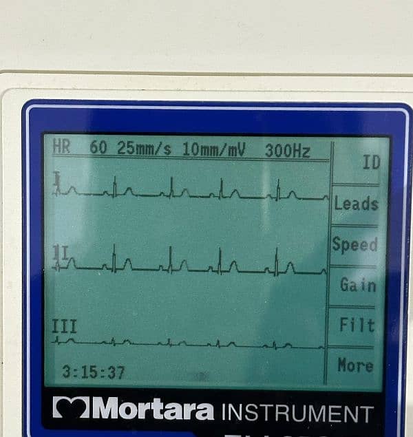 ECG Machines (03, 06 & 12 Channel) Accurate & Reliable ECG 4