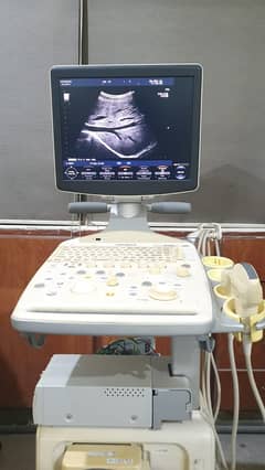 used portable ultrasound machine/ ultrasound machines