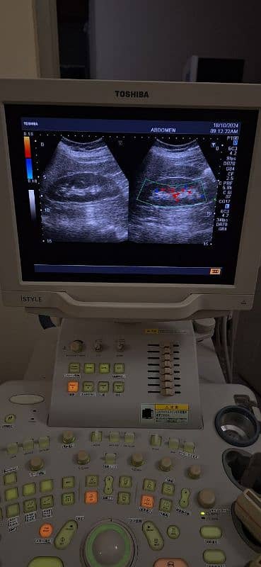 ultrasound mechanics 3