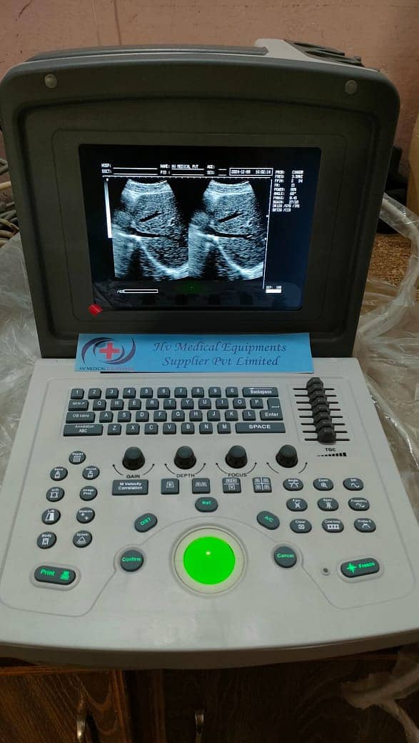 Brand new Ultrasound machine Chinese (with or without battery backup) 3