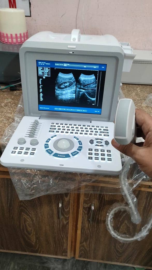 Brand new Ultrasound machine Chinese (with or without battery backup) 5