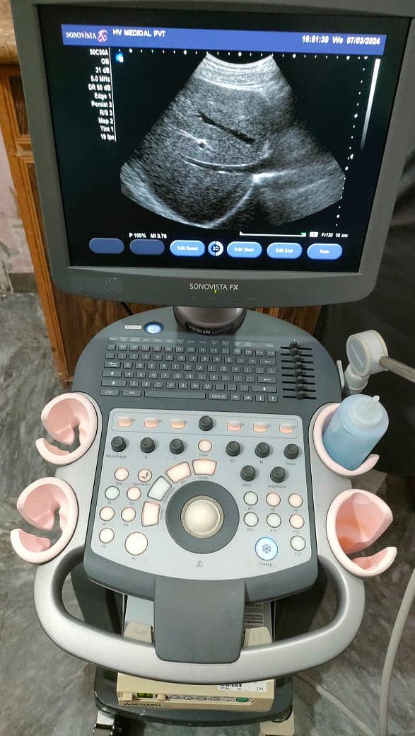 Refurb japaense color Doppler  portable & trolley mounted ultrasound 2