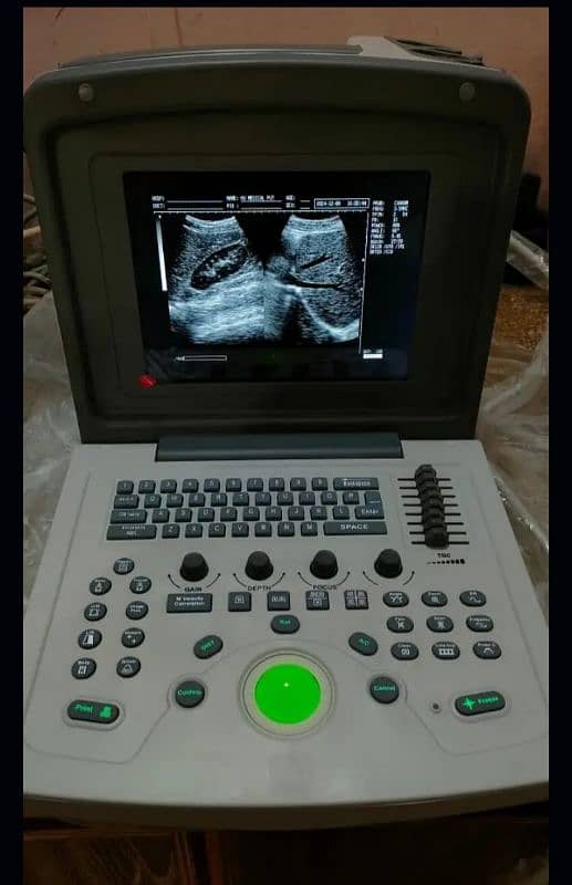 Ultrasound machine Sale offer Whtsap-03126807471 3