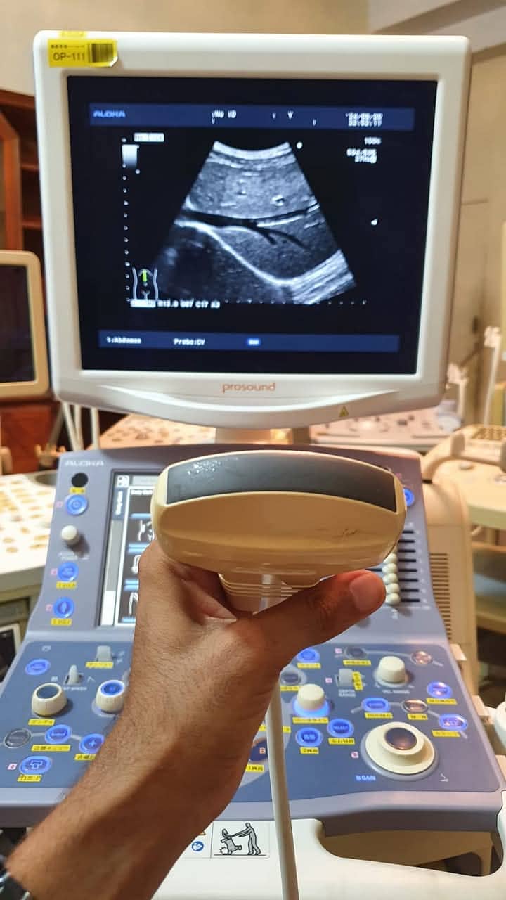 used portable ultrasound machine, ultrasound machines 18