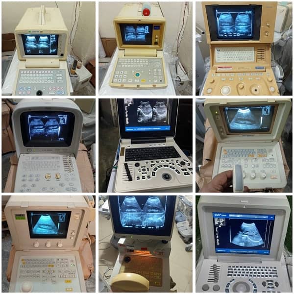 portable ultrasound machines in low price 0