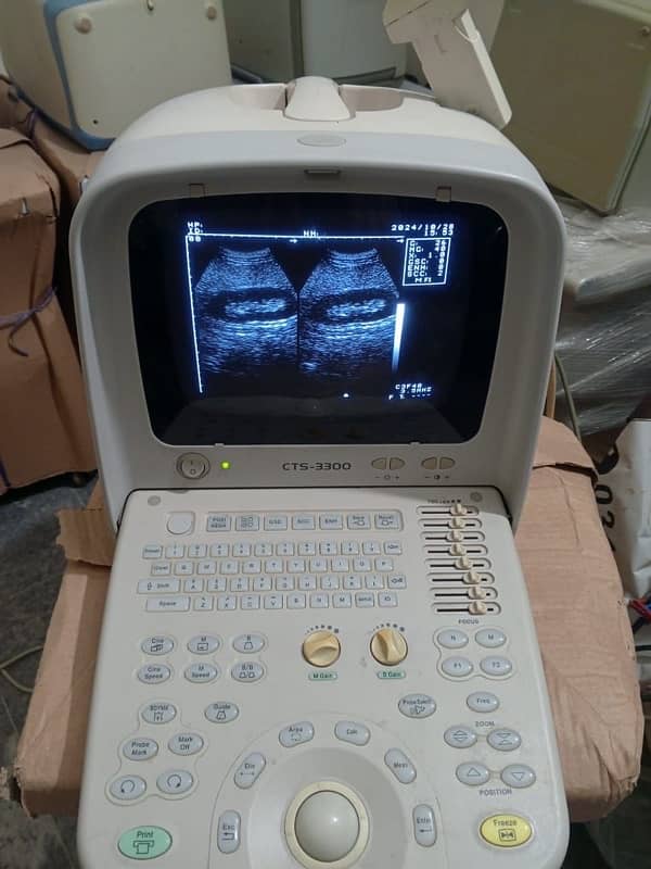 portable ultrasound machines in low price 4