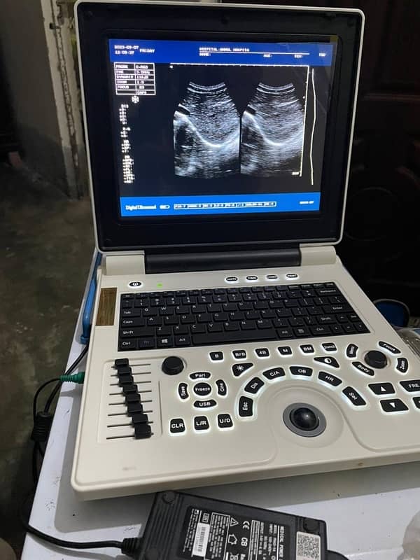 portable ultrasound machines in low price 5