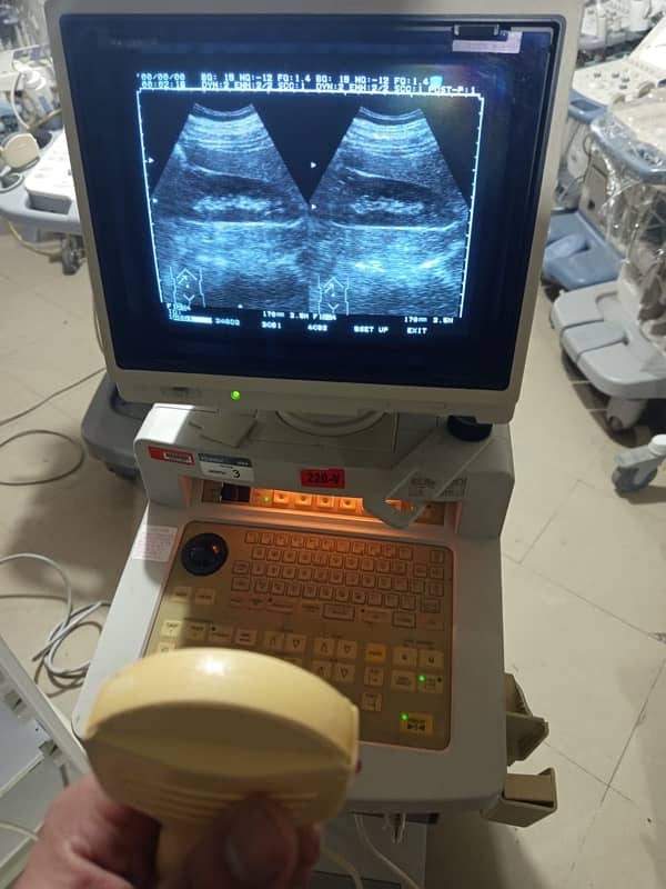 portable ultrasound machines in low price 6