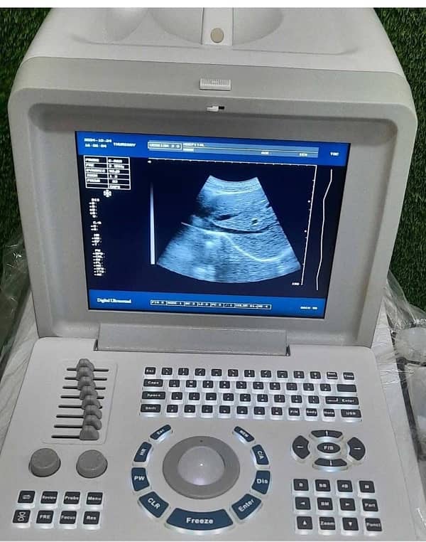 portable ultrasound machines in low price 8