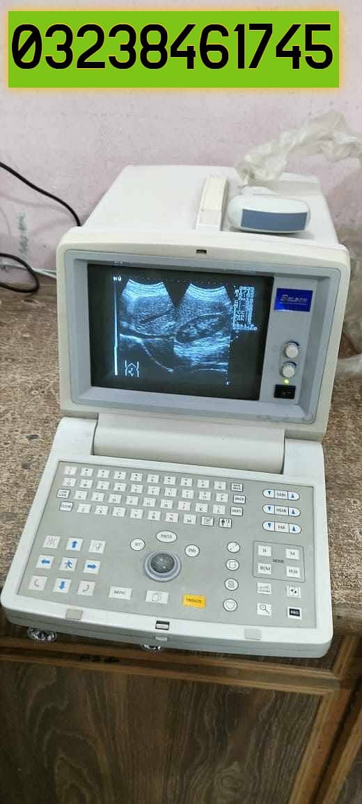 used china belson 200c ultrasound machine in low price 0