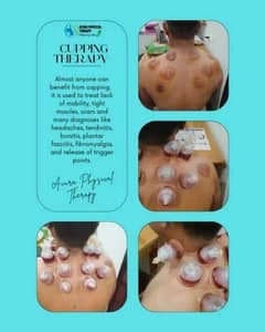 Hijama At Home