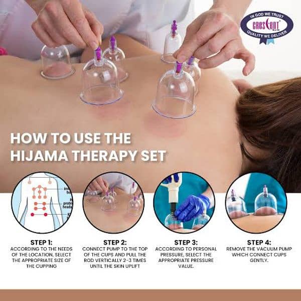 Hijama At Home 1