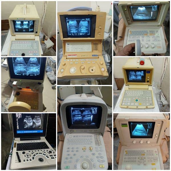 portable Ultrasound machines (fresh imported stock) 0