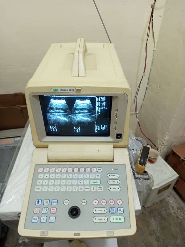 portable Ultrasound machines (fresh imported stock) 1