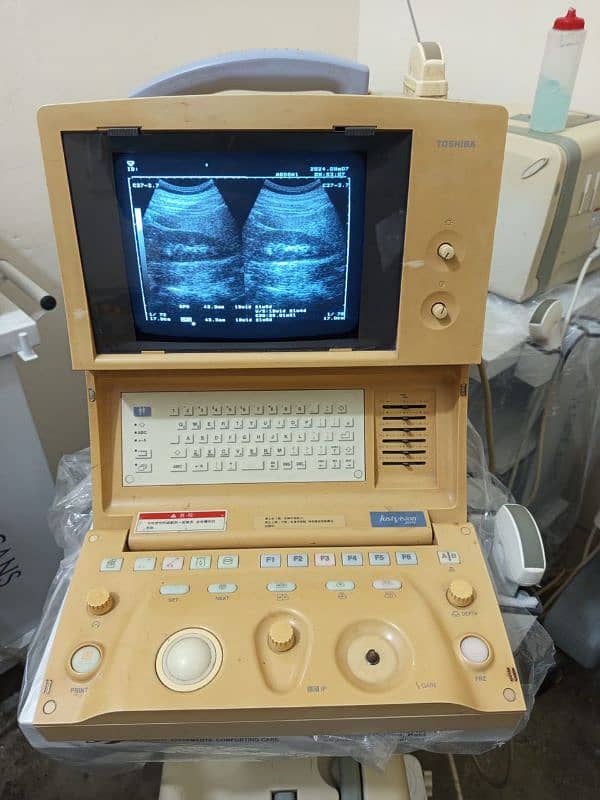 portable Ultrasound machines (fresh imported stock) 2